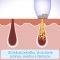 MEDIASHOP DERMASUCTION